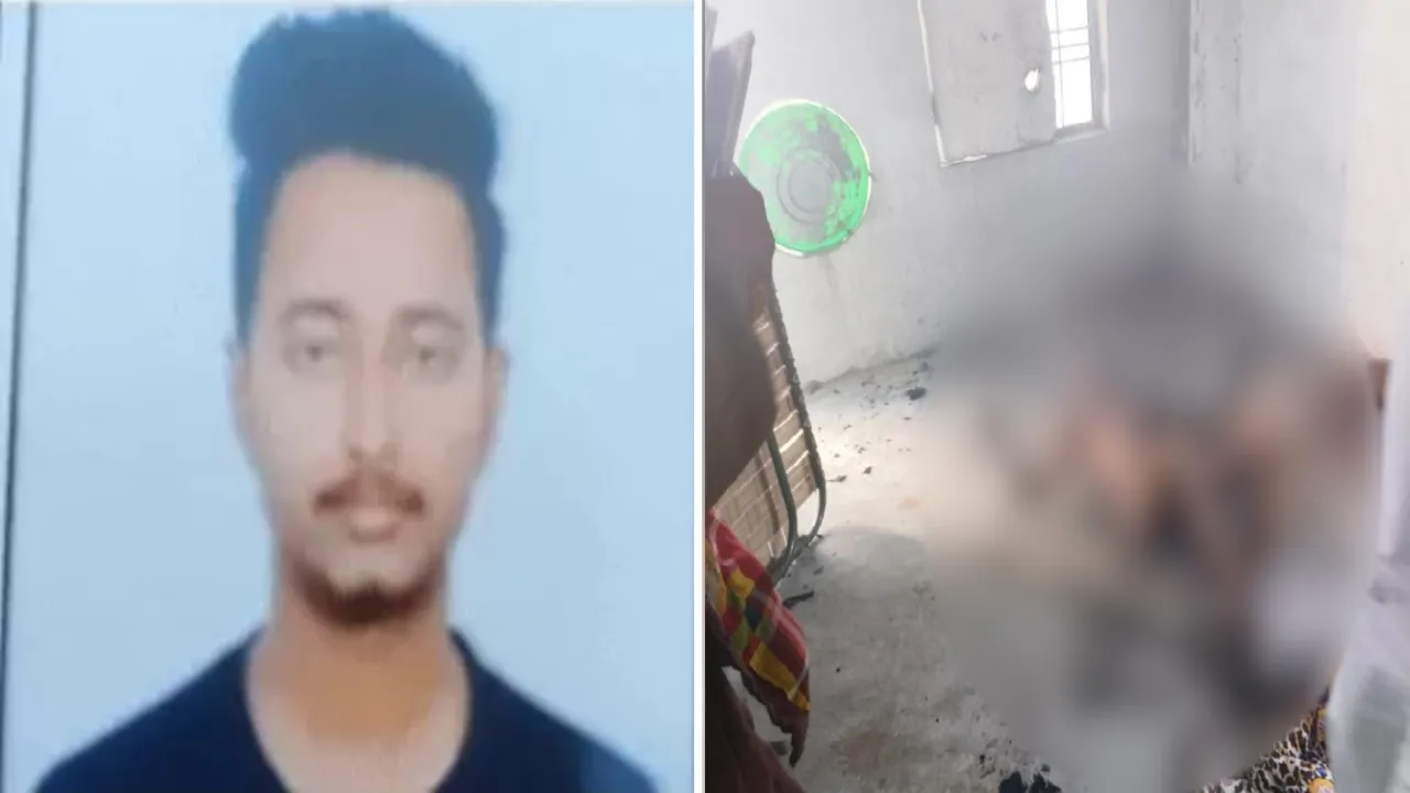 आत्मघाती कदम : शिक्षक के इकलौते बेटे ने खुद पर तारपीन का तेल डाल लगाई आग