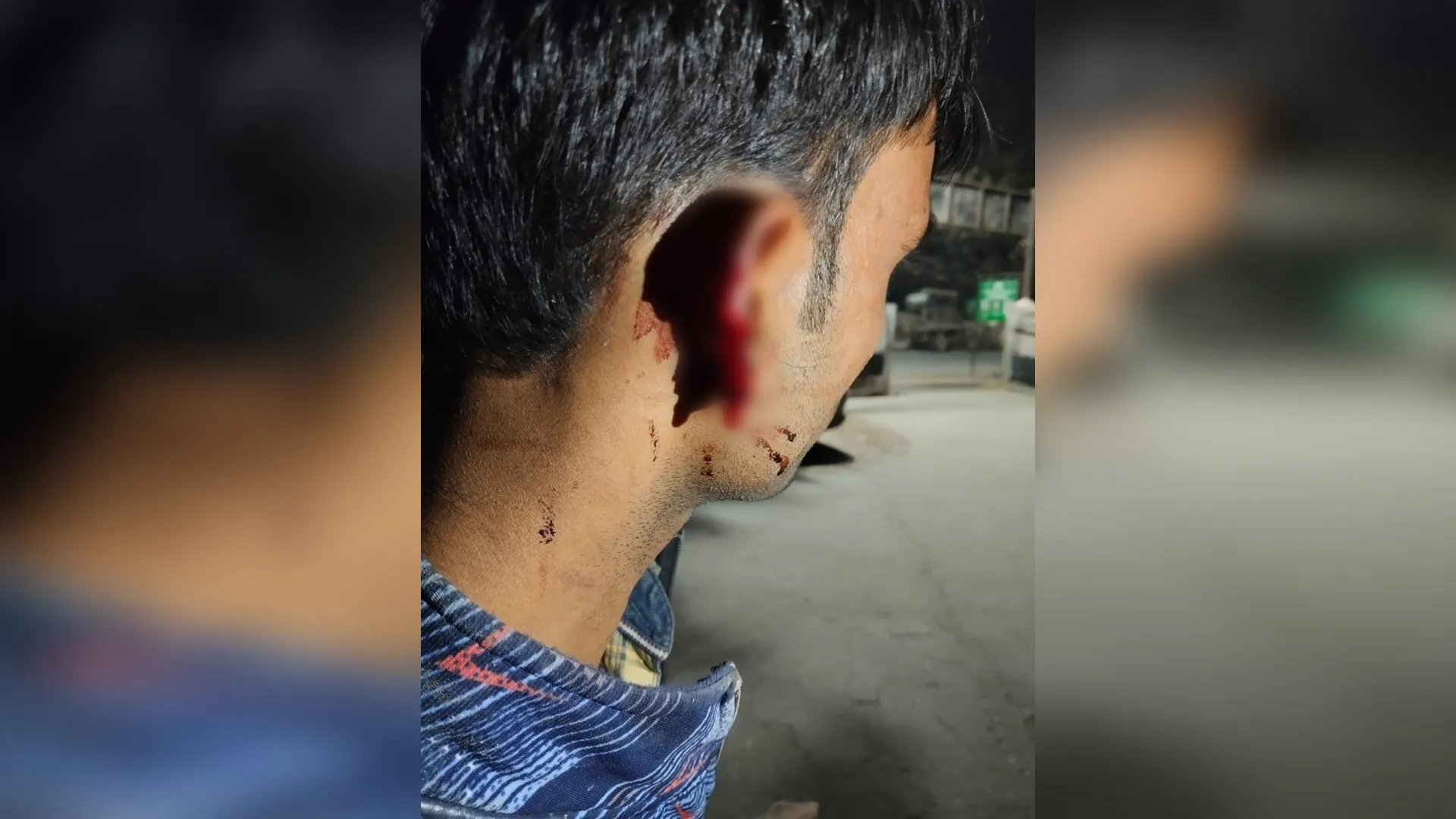 बदायूं : राजमिस्त्री का काटा कान, निर्माण कार्य रोकने का किया प्रयास