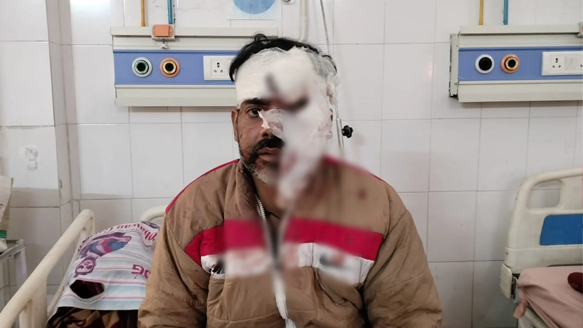 मुरादाबाद : रेलवे लाइन पार करते समय हादसा, युवक गंभीर रूप से घायल