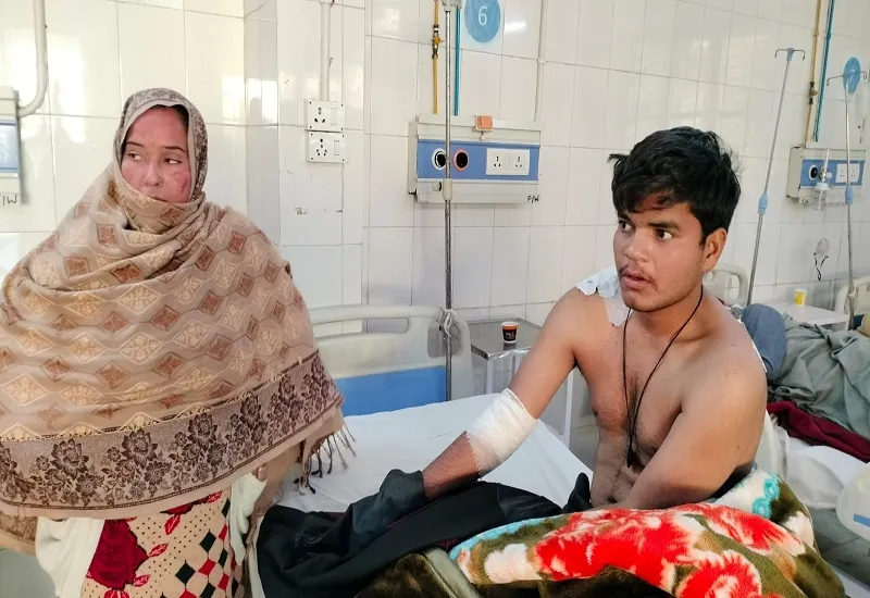 Moradabad : मामूली कहासुनी को लेकर 11वीं के छात्र के मारे चाकू, जिला अस्पताल में भर्ती