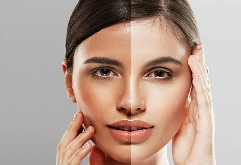 भोजन और दवाएं बदल सकती हैं त्वचा का रंग, कई बार स्थायी रूप से भी 