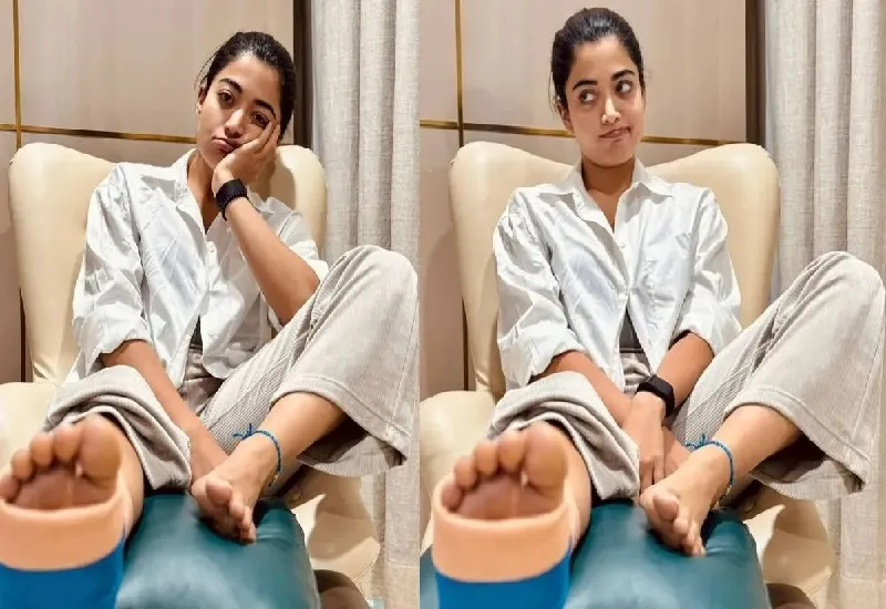 रश्मिका मंदाना के पैर पर प्लास्टर, 'थामा', 'सिकंदर' और 'कुबेर' के डायरेक्टर्स से मांगी माफी, बोलीं-जल्द काम पर लौटूंगी