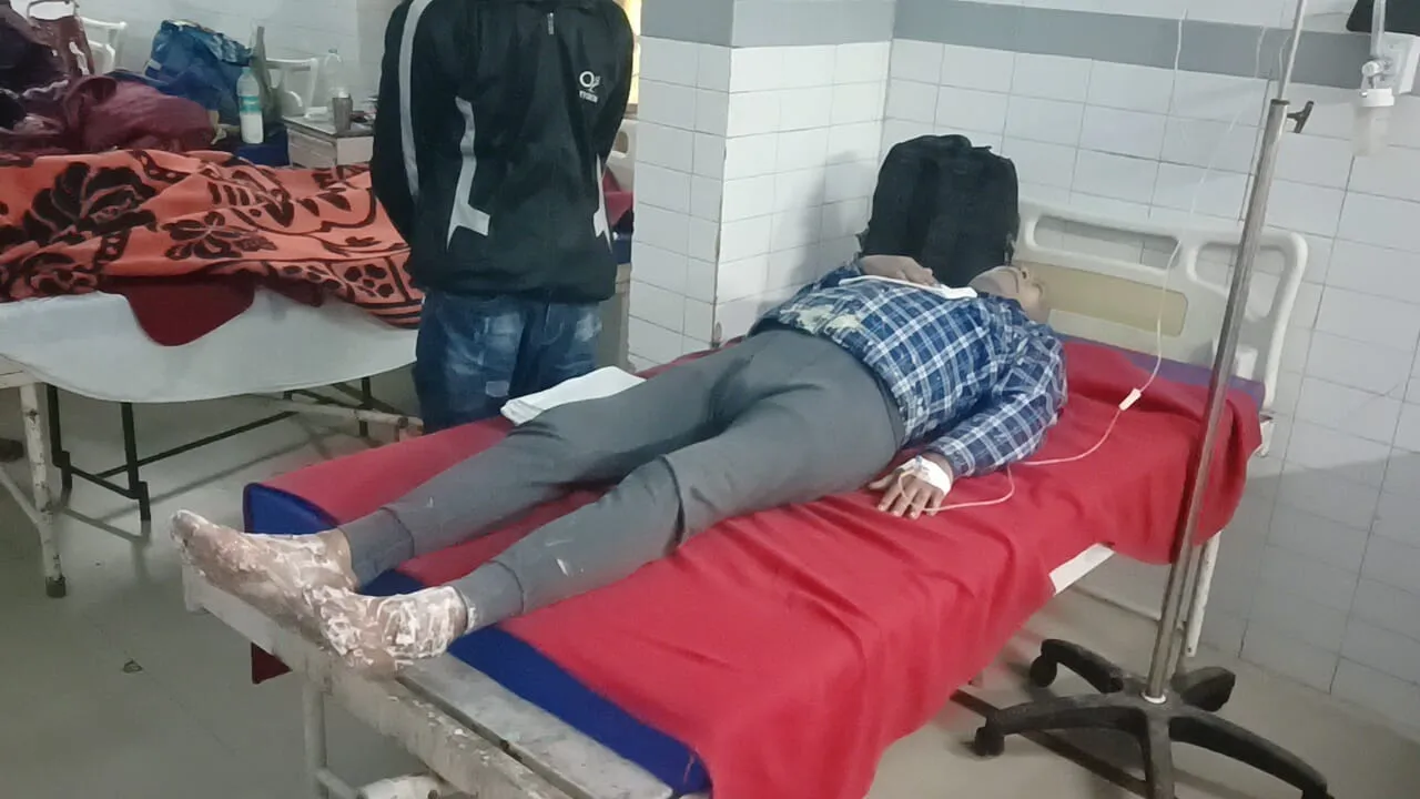 बहराइच : श्रावस्ती सहकारी चीनी मिल में सल्फर का केन खोलते समय हादसा, संविदाकर्मी झुलसा