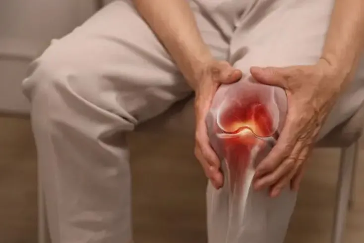 बरेली: महिलाओं के साथ पुरुषों में भी बढ़ा गठिया रोग, मरीज़ों की संख्या में इज़ाफा