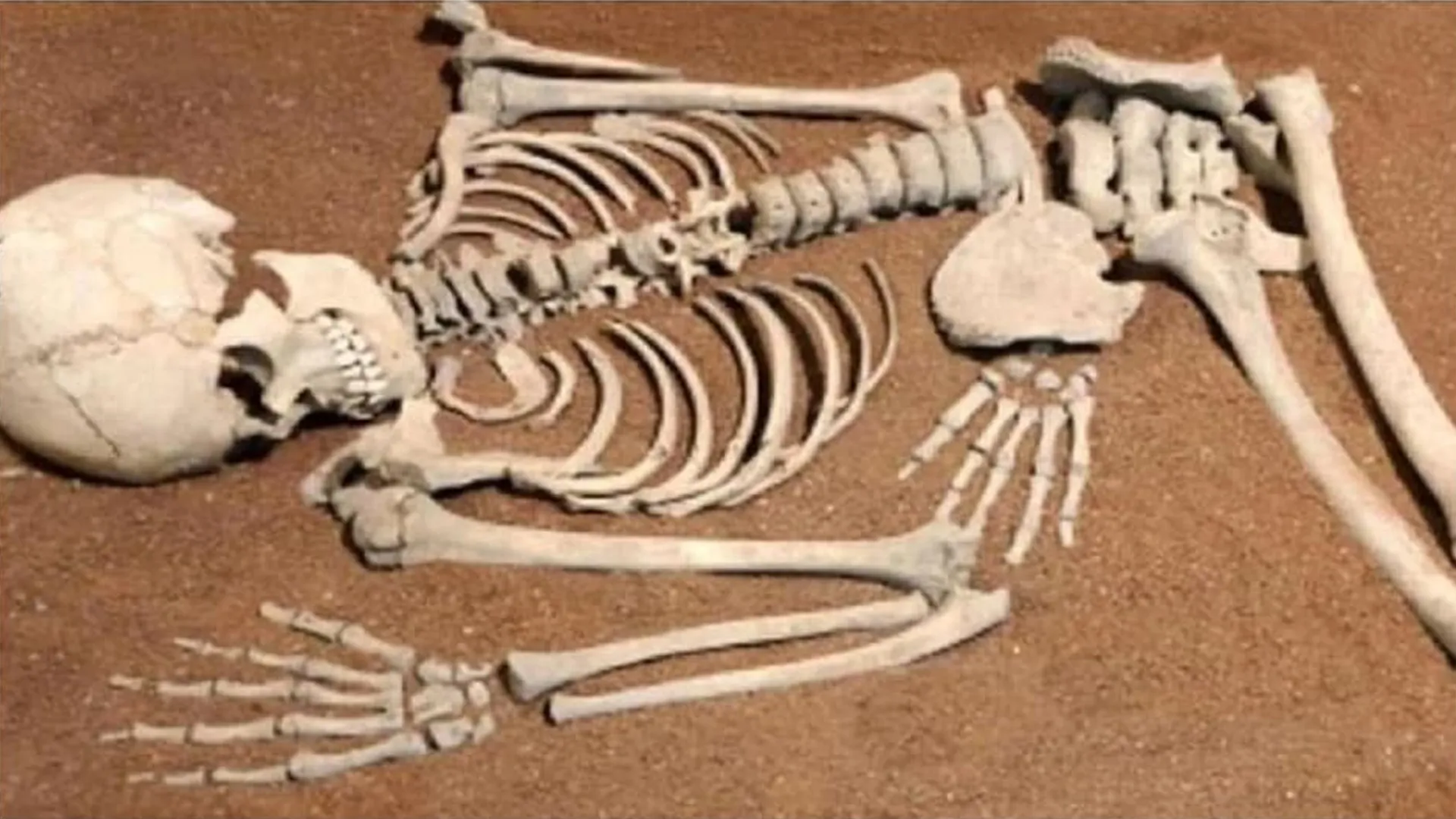 पीलीभीत: खेत में नरकंकाल मिलने से हड़कंप, महिला बोली मेरा लापता पति तो नहीं...