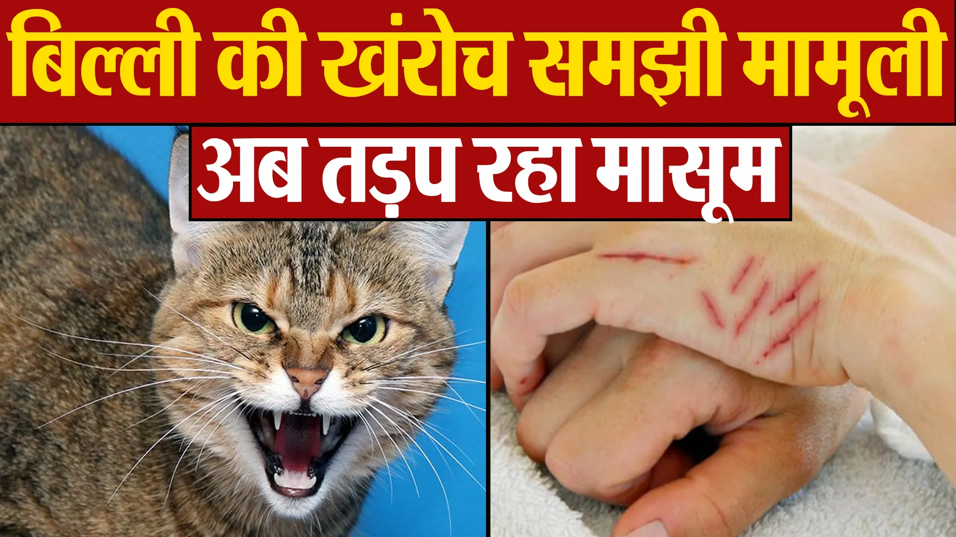 Bareilly: पालतू बिल्ली ने मारा था पंजा...अब पानी देखकर तड़पने लगा पांच साल का मासूम !