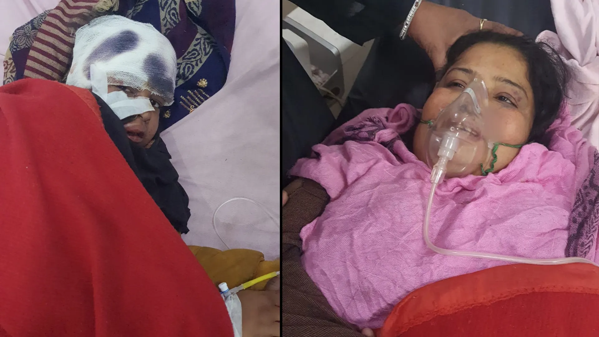 रामपुर : सड़क हादसे में पिता-पुत्री की मौत, मां-बेटी घायल