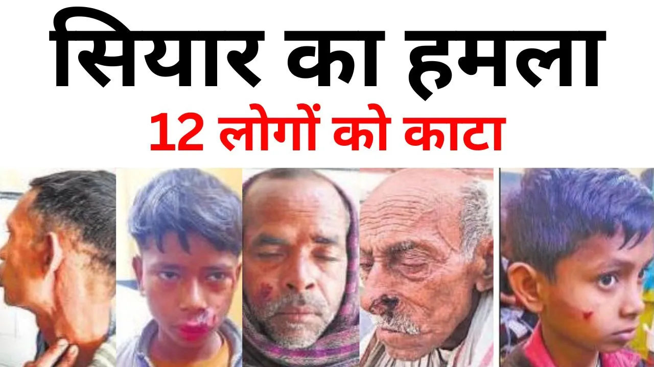 Bareilly: सियार के हमले से दहशत, 12 लोगों को बनाया निशाना, किसी का हाथ तो किसी काटा मुंह