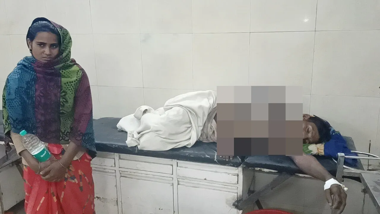बहराइच: पत्नी से विवाद के बाद युवक ने चाचा से माचिस लेकर खुद को लगाई आग, लखनऊ रेफर 