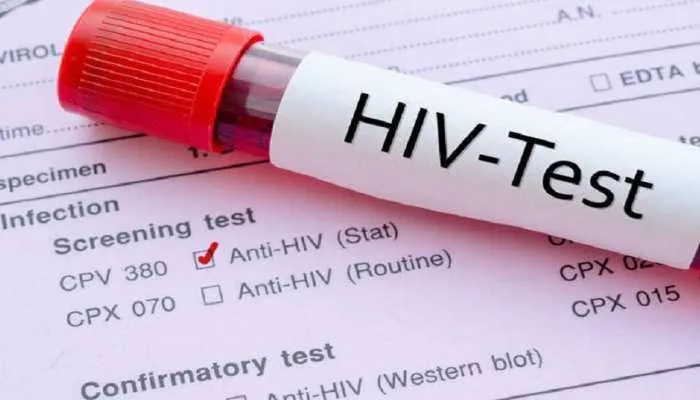 एसटीएच में एचआईवी किट खत्म होने से जांच बंद