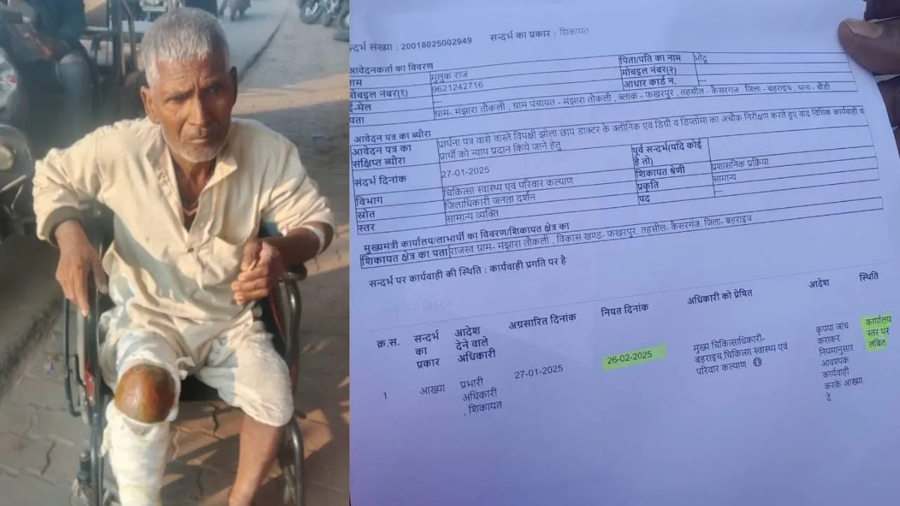 बहराइच: झोलाछाप के गलत इलाज से बुजुर्ग के पैर में फैला इंफेक्शन, काटने की आई नौबत, शिकायत के बाद भी स्वास्थ्य विभाग नहीं कर रहा कार्रवाई