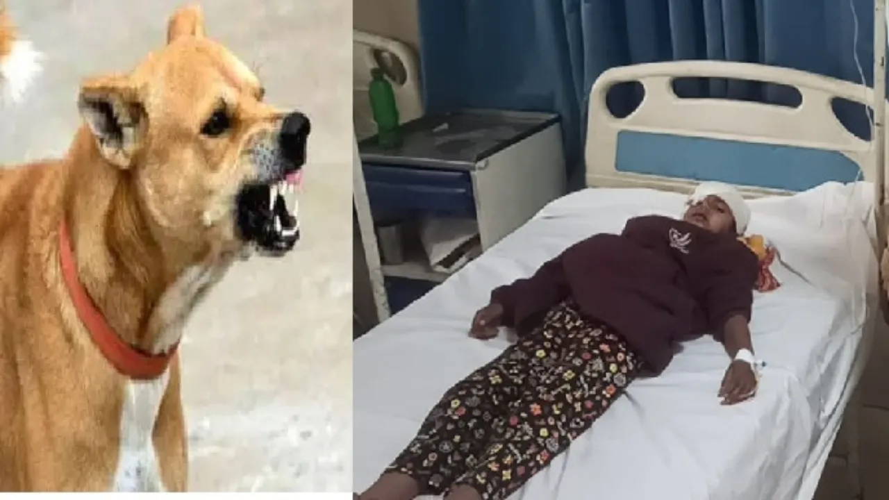 Bahraich News : मवेशियों पर हमला करने के बाद राहगीरों पर झपट रहा स्ट्रीट डॉग का झुंड, अब छात्रा समेत दो लोग के शरीर से निकाला मांस