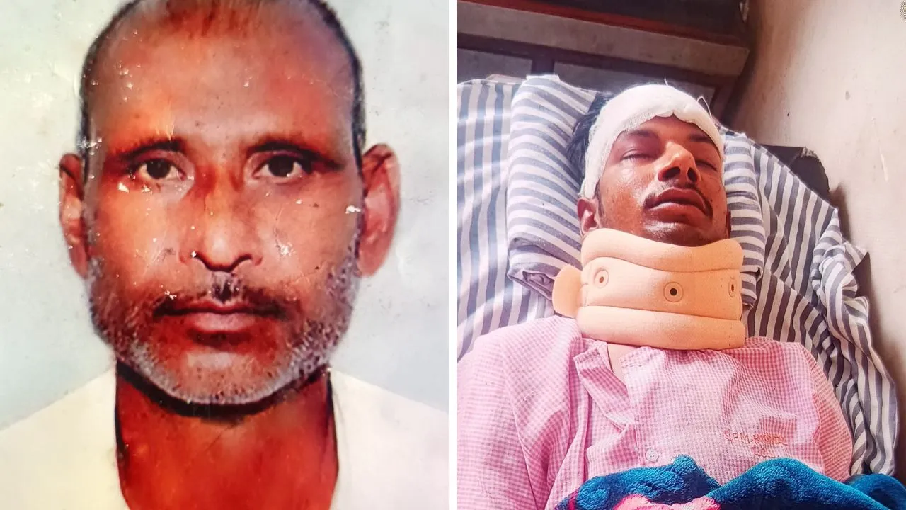 Kanpur में तेज रफ्तार कार ने पिता-पुत्र को उड़ाया: हादसे में पांच फुट ऊपर उछले दोनों, पिता की मौत, बेटा गंभीर