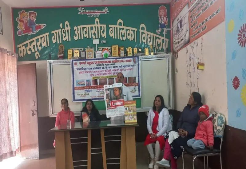 मुरादाबाद : कुष्ठ रोग से बचाव के लिए जानकारी बहुत जरूरी