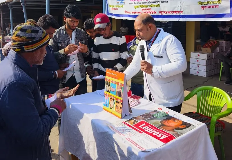मुरादाबाद : कुष्ठ रोगी व उनके परिवार से न करें घृणा, दें सहयोग