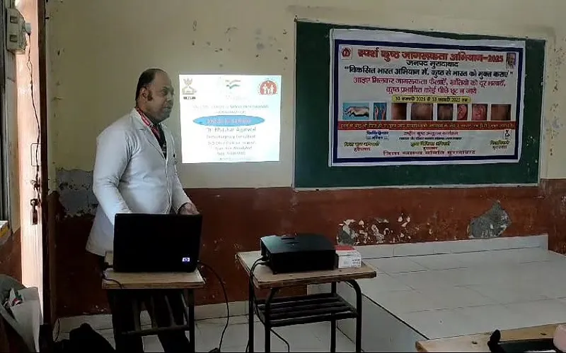 मुरादाबाद : सही खानपान व तनावमुक्त जीवनशैली से बढ़ाएं रोग प्रतिरोधक क्षमता