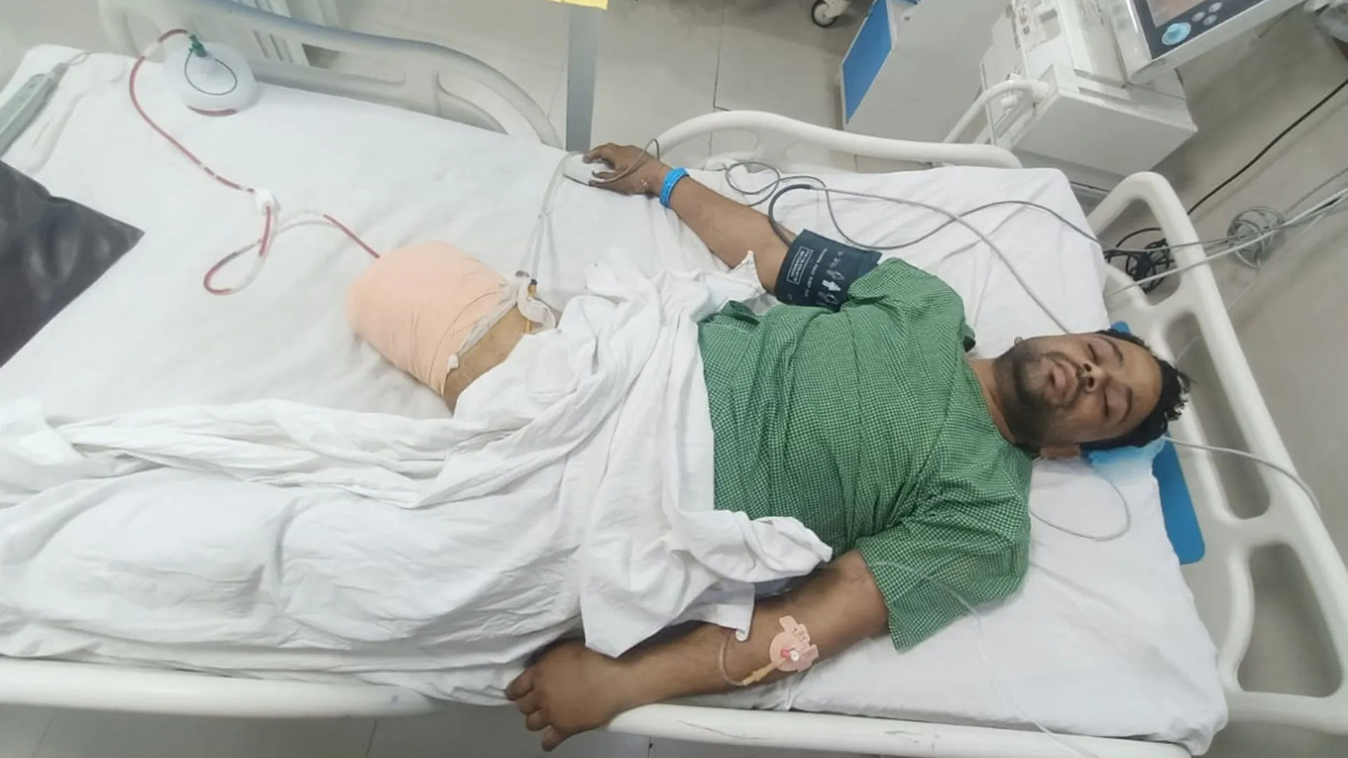 Bareilly: इनामी बदमाश शेरा ने गंवाया दाहिना पैर...मुठभेड़ में गोली लगने से फैला संक्रमण