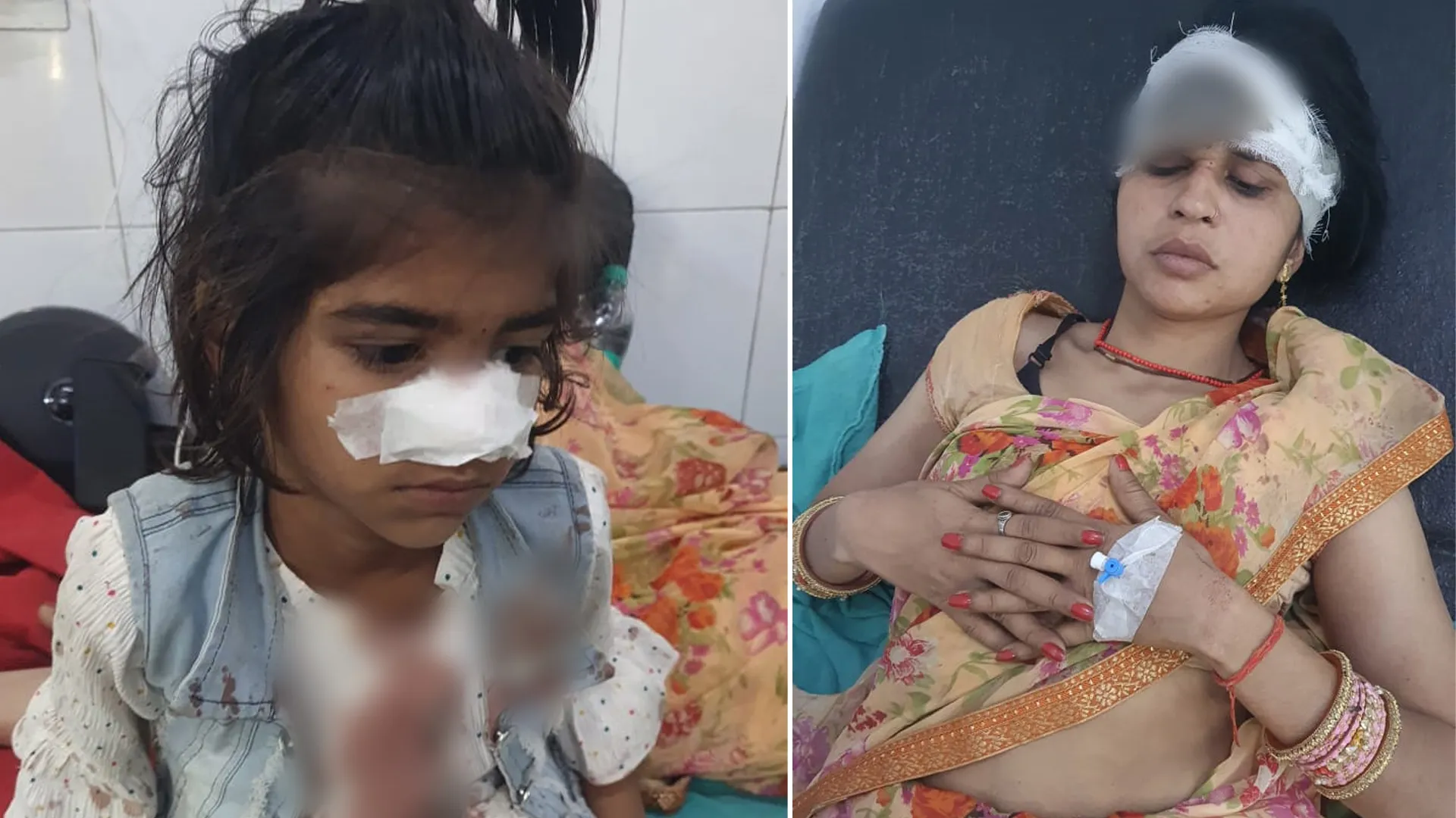 रामपुर: अजीतपुर बाईपास पर डबल डेकर बस और ट्रक की भिड़ंत में 11 यात्री घायल