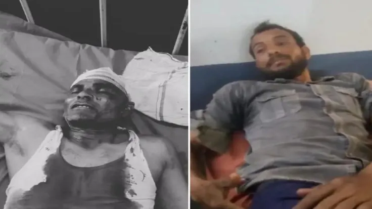 बिजनौर में फिर गुलदार का हमला, किसान गंभीर रूप से घायल, ग्रामीणों में आक्रोश