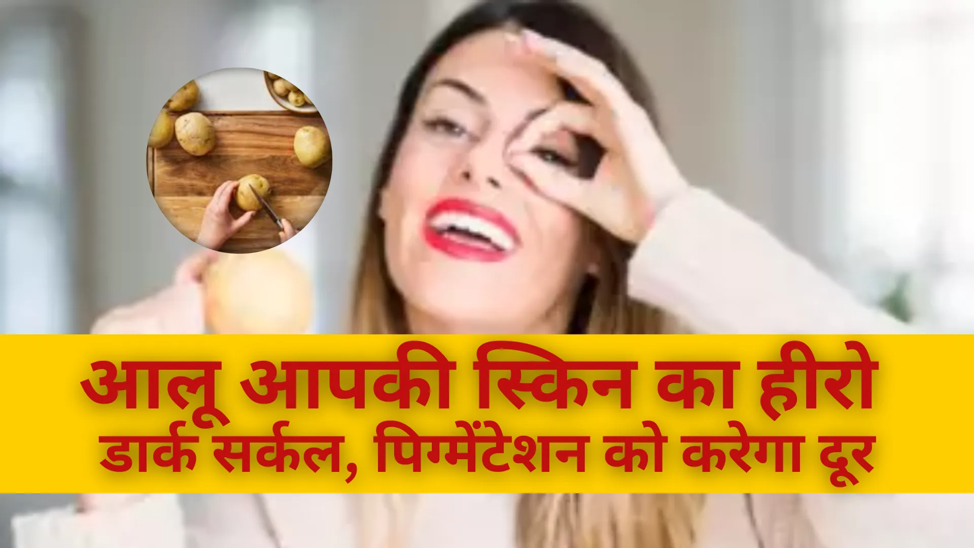 आलू आपकी स्किन का हीरो,  डार्क सर्कल, पिग्मेंटेशन को करेगा दूर