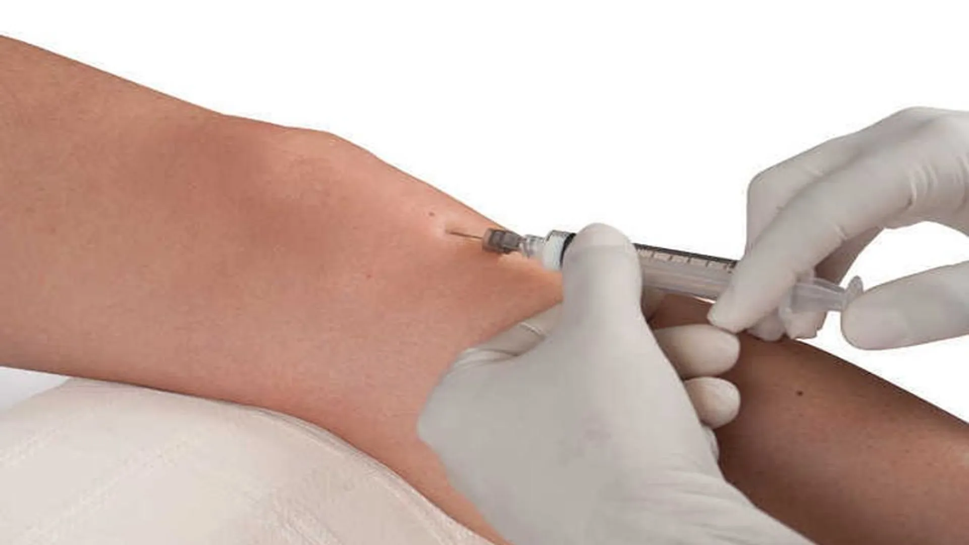 Bareilly: ड्रग वेयर हाउस में एंटी रैबीज सीरम...फिर भी मरीजों की जेब हो रही ढीली