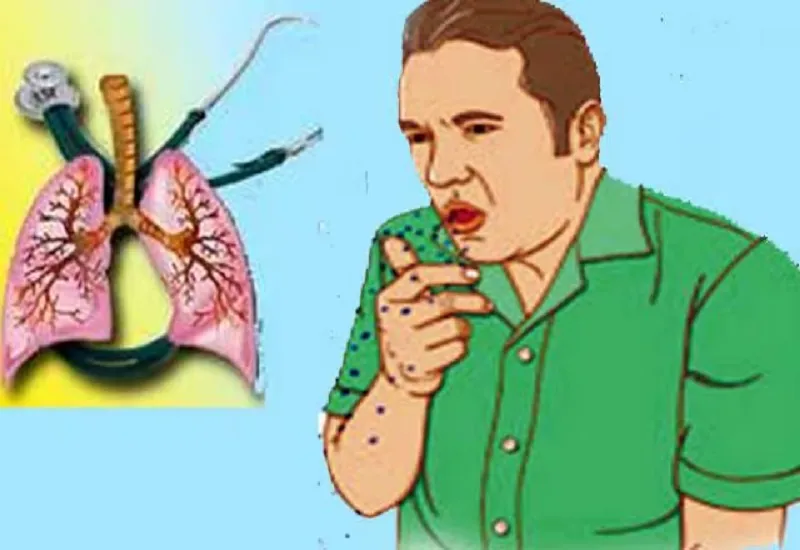 ब्रिटेन और अमेरिका में टीबी के बढ़ते मामले क्यों है सभी के लिए चिंता का विषय?