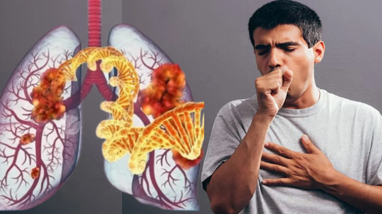 साइलेंट किलर इंटरस्टीशियल लंग डिजीज को न करें नजरअंदाज, जानें कैसे बना रही लोगों को शिकार, SGPGI में विशेषज्ञों ने किया अलर्ट 