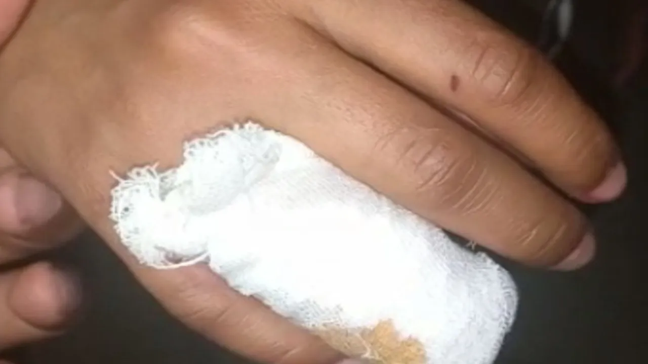 नशे में हैवान बना व्यक्ति, पहले की मारपीट, फिर दांतों से काटकर अलग कर दी पत्नी की उंगली 