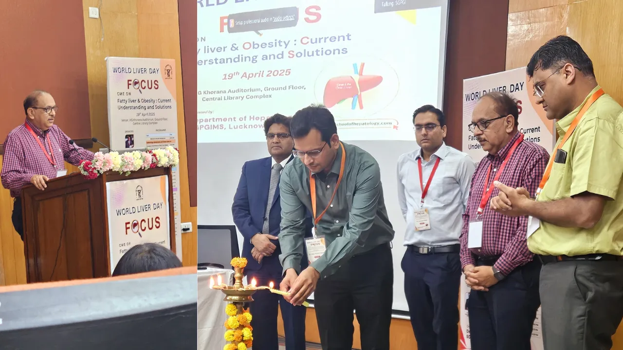World Liver Day 2025: फैटी लिवर देश में रोगों के बढ़ते बोझ का कारण, मोटापे से बढ़ती है समस्या, वजन कम करने से हो सकता है लाभ
