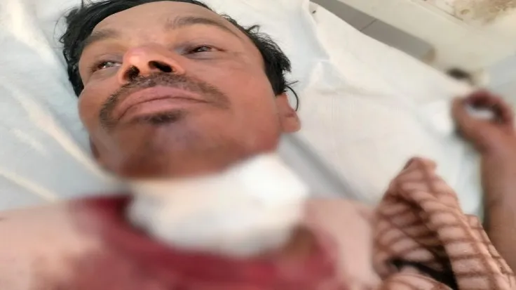 मुरादाबाद: पति ने धारदार हथियार से खुद का गला रेता, पत्नी से हुआ था झगड़ा