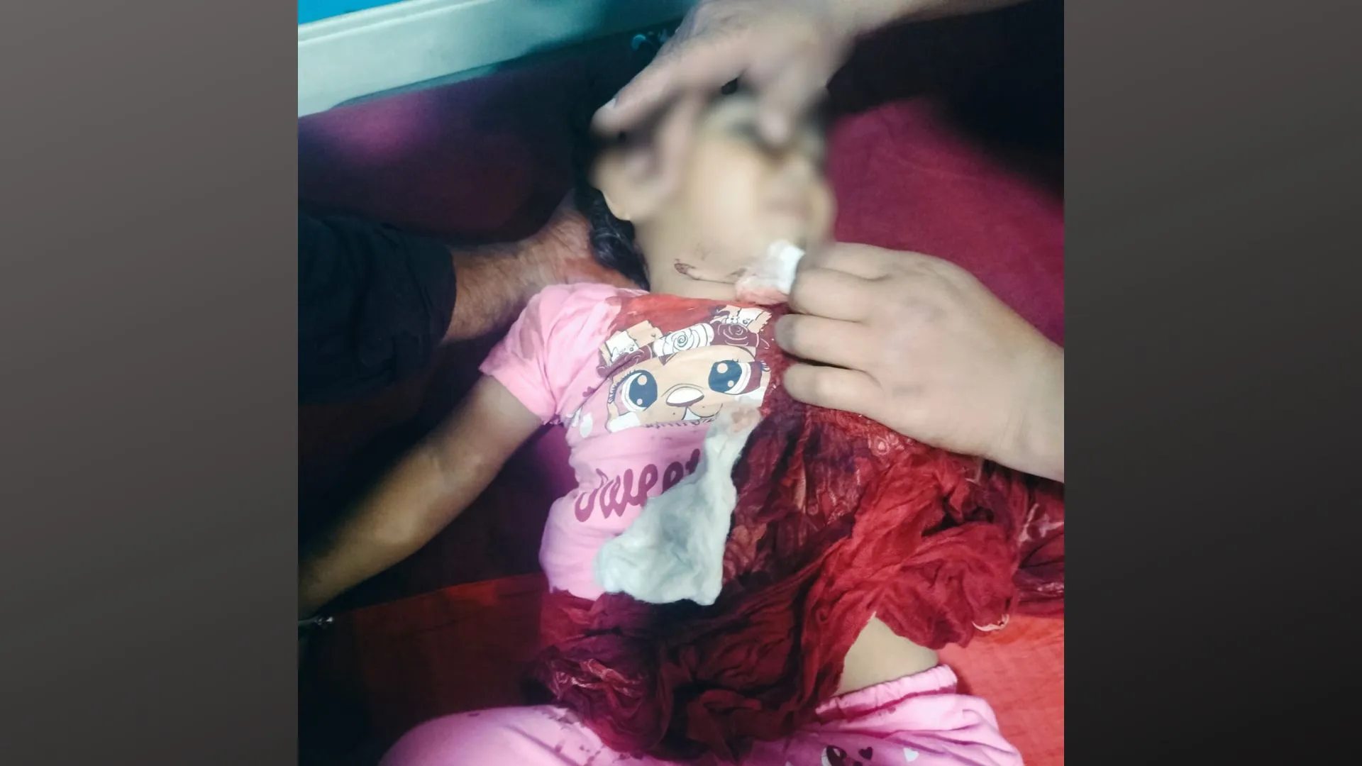 हरदोई: 8 वर्षीय बच्ची की चाइनीज मांझा से गर्दन कटी, गंभीर रूप से घायल  