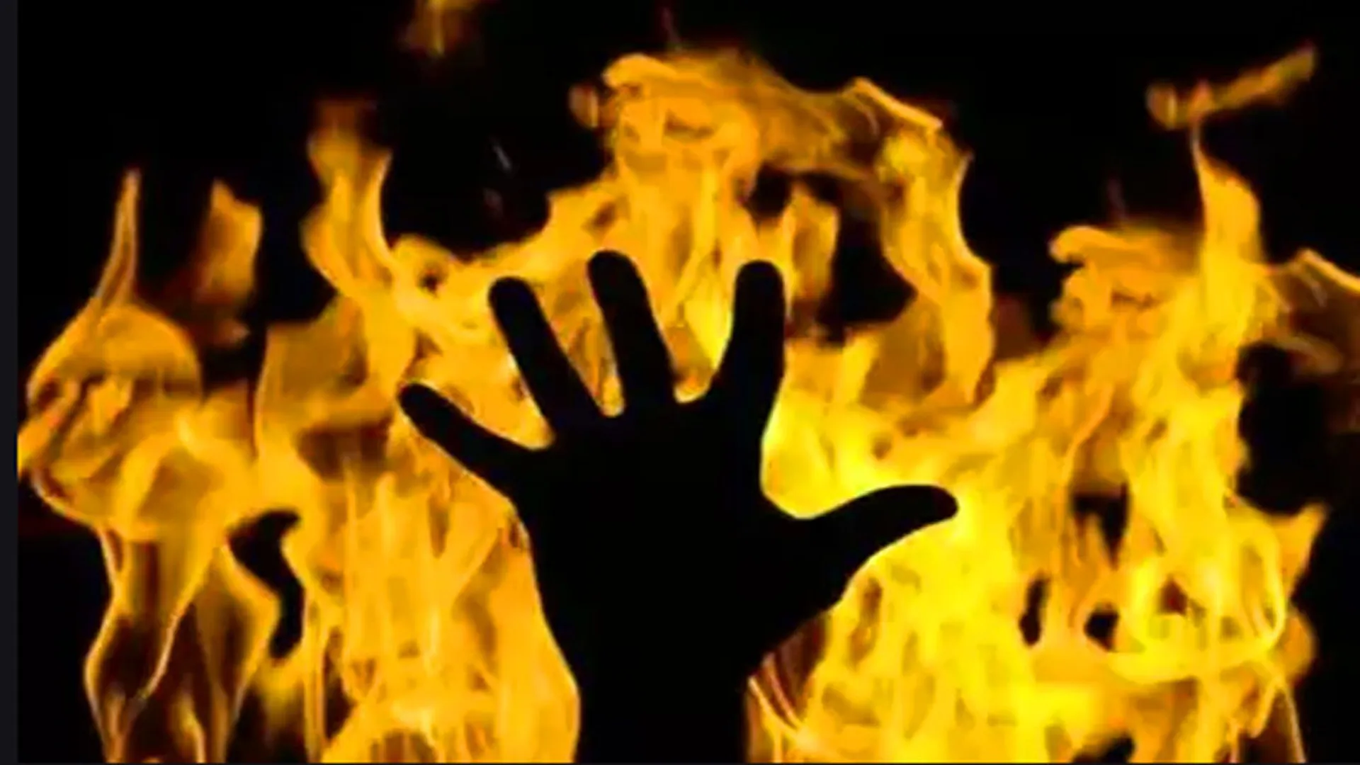 रामपुर: दहेज में 3 लाख नहीं मिले तो महिला को जिंदा जलाने का प्रयास