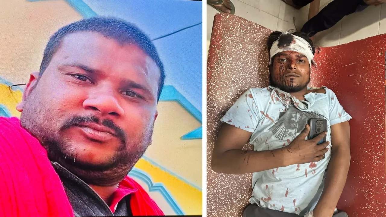 Lucknow News : तंज कसने पर युवक की गर्दन पर बेल्चे से किया वार, हमलावर गिरफ्तार