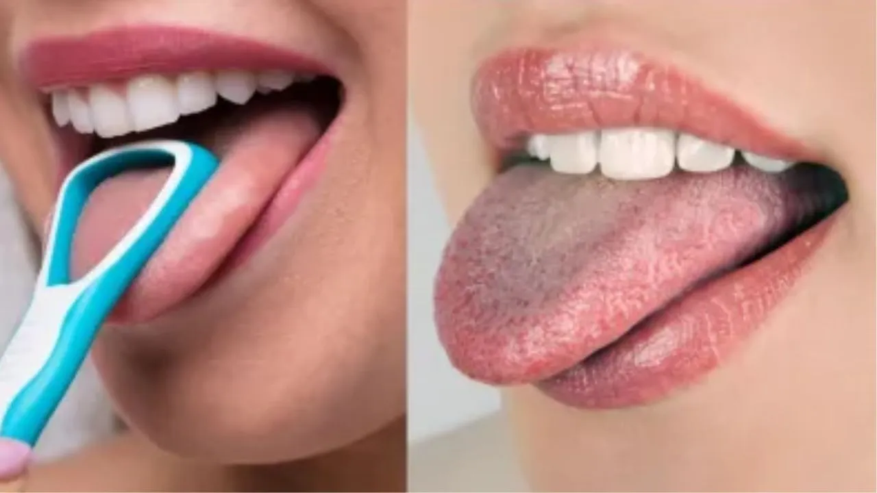 Bareilly: जीभ की सफाई नहीं की तो बढ़ जाएंगी बीमारियां, ऐसे बरतें सावधानी