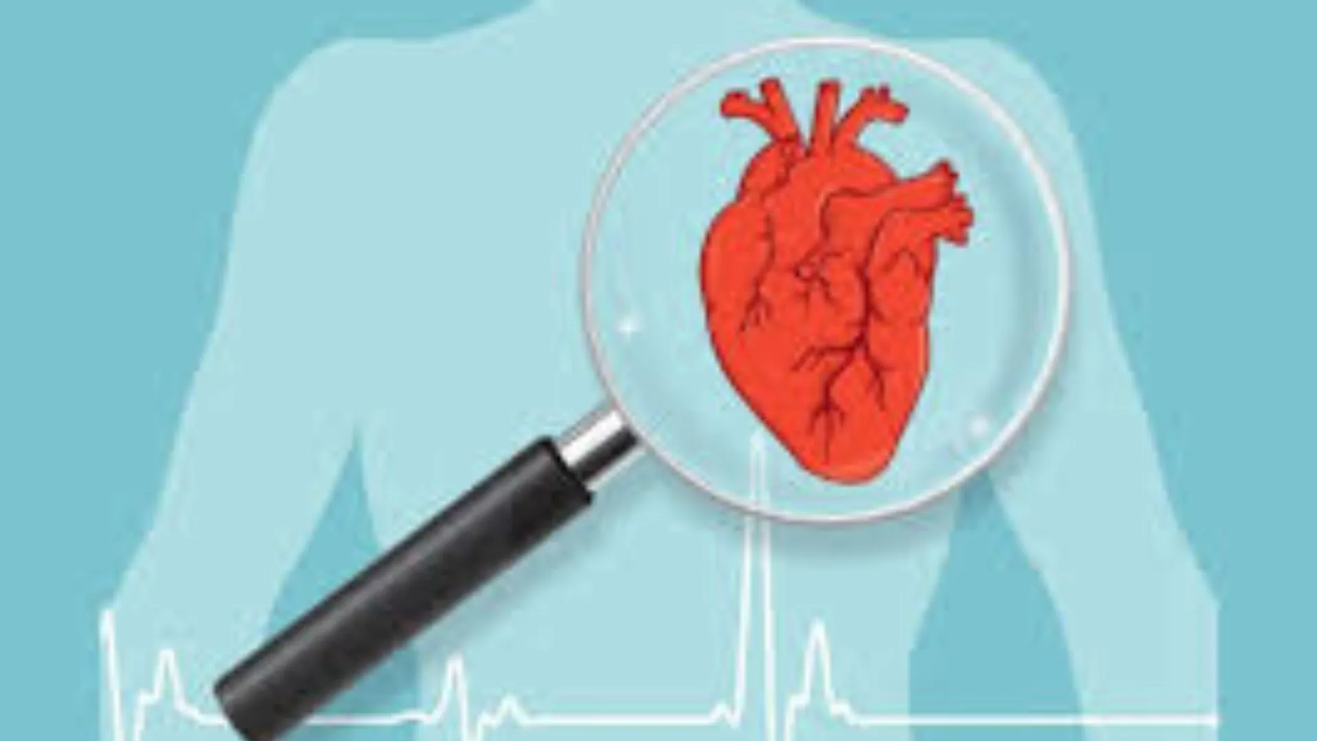 AI तकनीक ने सर्जरी को बनाया आसान, PGI में मरीजों की सफल Angioplasty