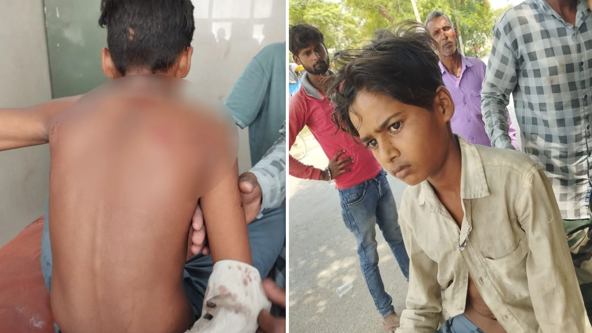 लखीमपुर खीरी: नाना को खेत पर खाना देने जा रहे किशोर पर तेंदुए ने किया हमला