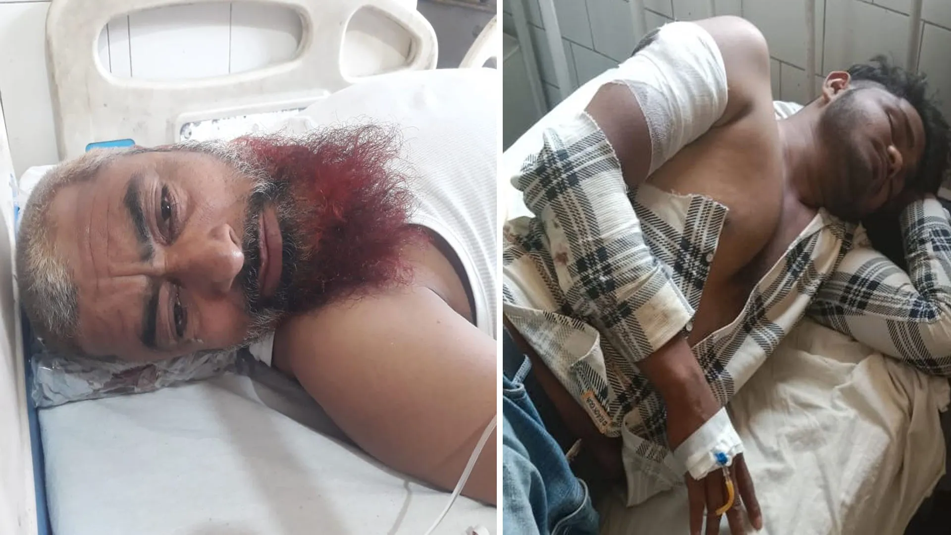 बदायूं: पुरानी रंजिश में फायरिंग से फैली दहशत...प्रधान समेत दो लोगों को लगी गोली