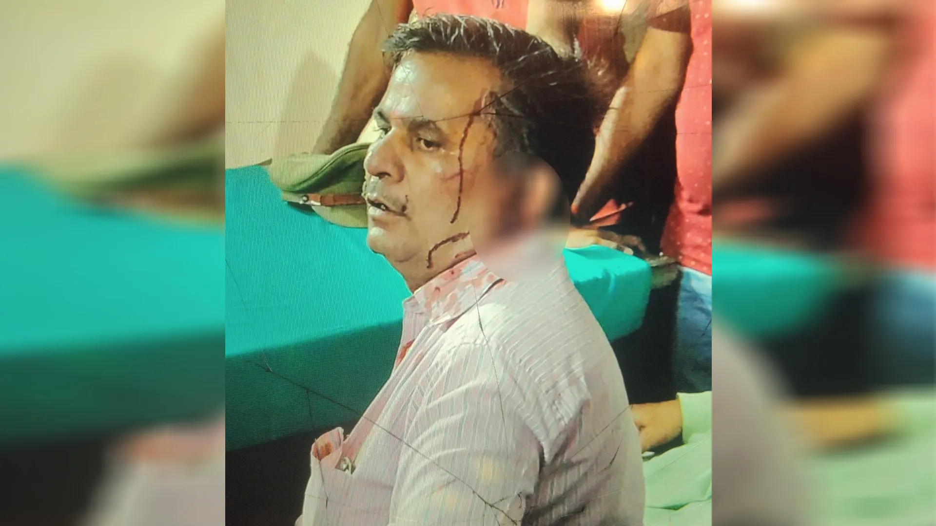 लखीमपुर खीरी: सर्राफा कारोबारी से मारपीट कर बदमाशों ने लूटे जेवर-नकदी