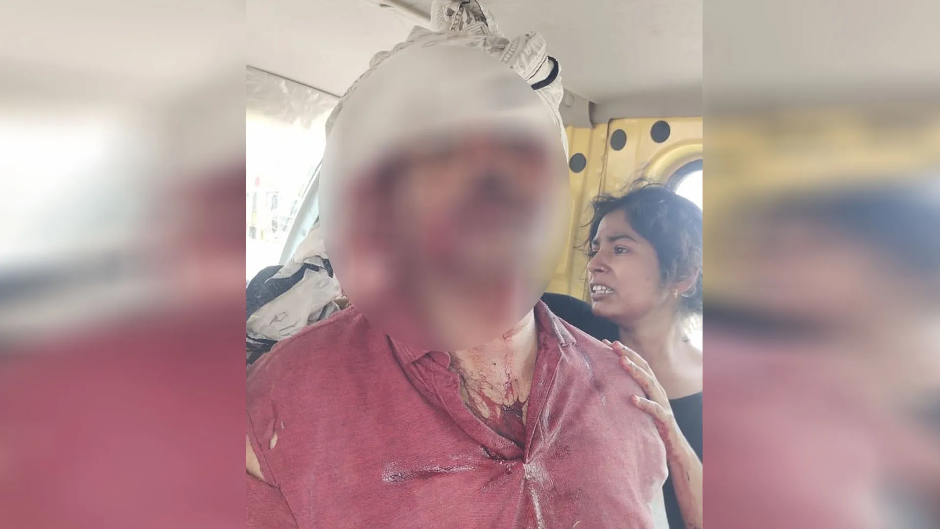 लखीमपुर खीरी: समर कैंप में ड्यूटी करने जा रहे शिक्षामित्र पर जानलेवा हमला 