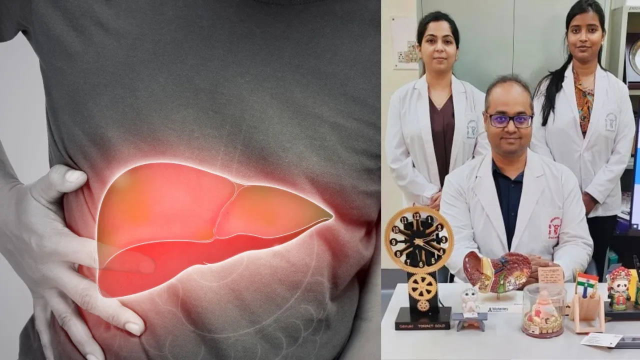 SGPGI के Doctors ने खोजा फैटी लिवर का इलाज, अब नहीं होना पड़ेगा लंबे समय तक परेशान