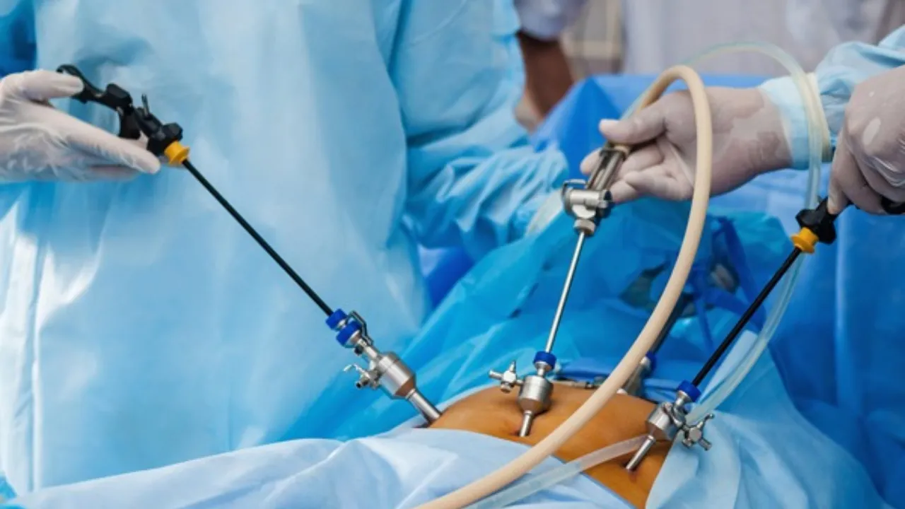 लोहिया संस्थान में दूरबीन से सर्जरी हुई लाइव, डॉक्टरों को किया गया प्रशिक्षित, बोले डॉक्टर- आज के समय में सबसे कारगर