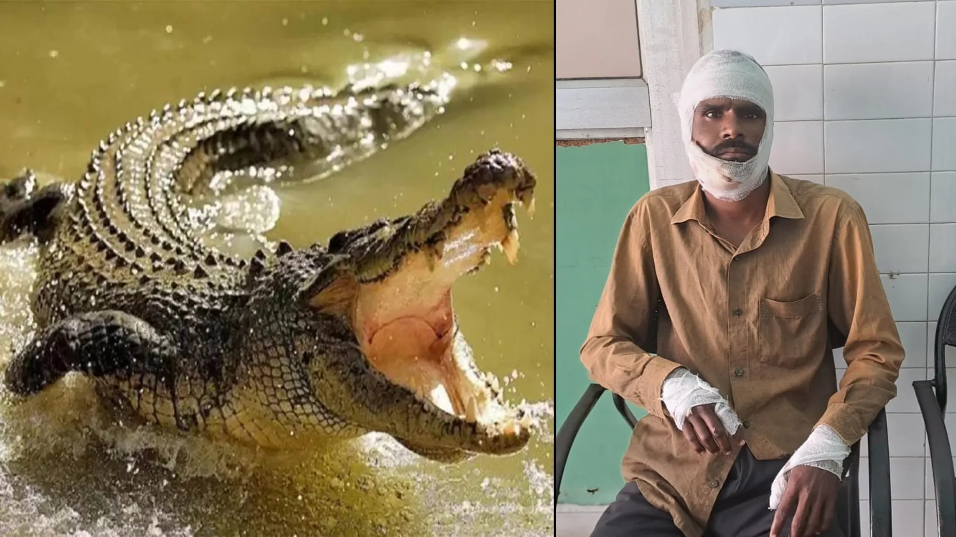 लखीमपुर खीरी : सोतिया नाला से निकले मगरमच्छ ने युवक पर किया हमला