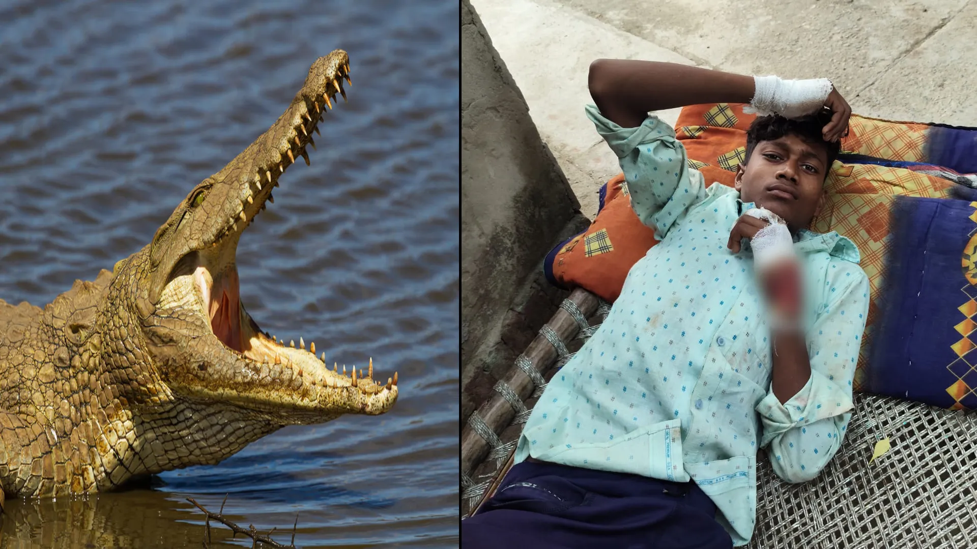 लखीमपुर खीरी : किशोर पर मगरमच्छ ने किया हमला, घायल