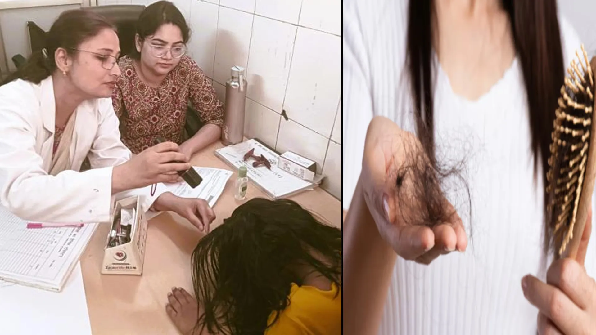 मुरादाबाद : पर्याप्त नींद न लेने और तनाव से भी झड़ते हैं बाल, डॉक्टर बोले- लाइलाज बीमारी नहीं
