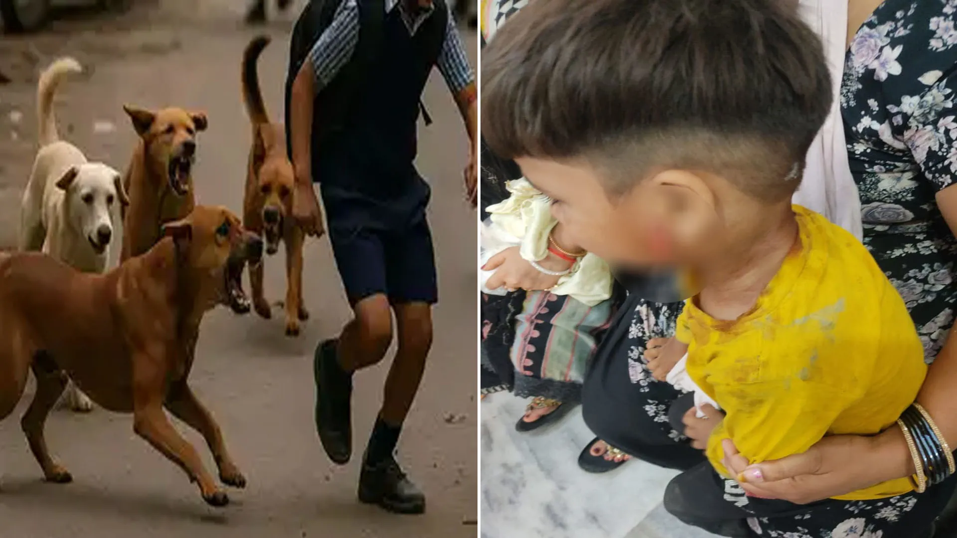 Bareilly: हिंसक कुत्तों के झुंड हो रहे हमलावर...चार साल के मासूम को कई बार काटा