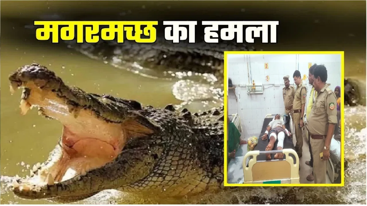 बाराबंकी में घड़ियाल का हमला : एक व्यक्ति जख्मी, जिला अस्पताल में भर्ती 
