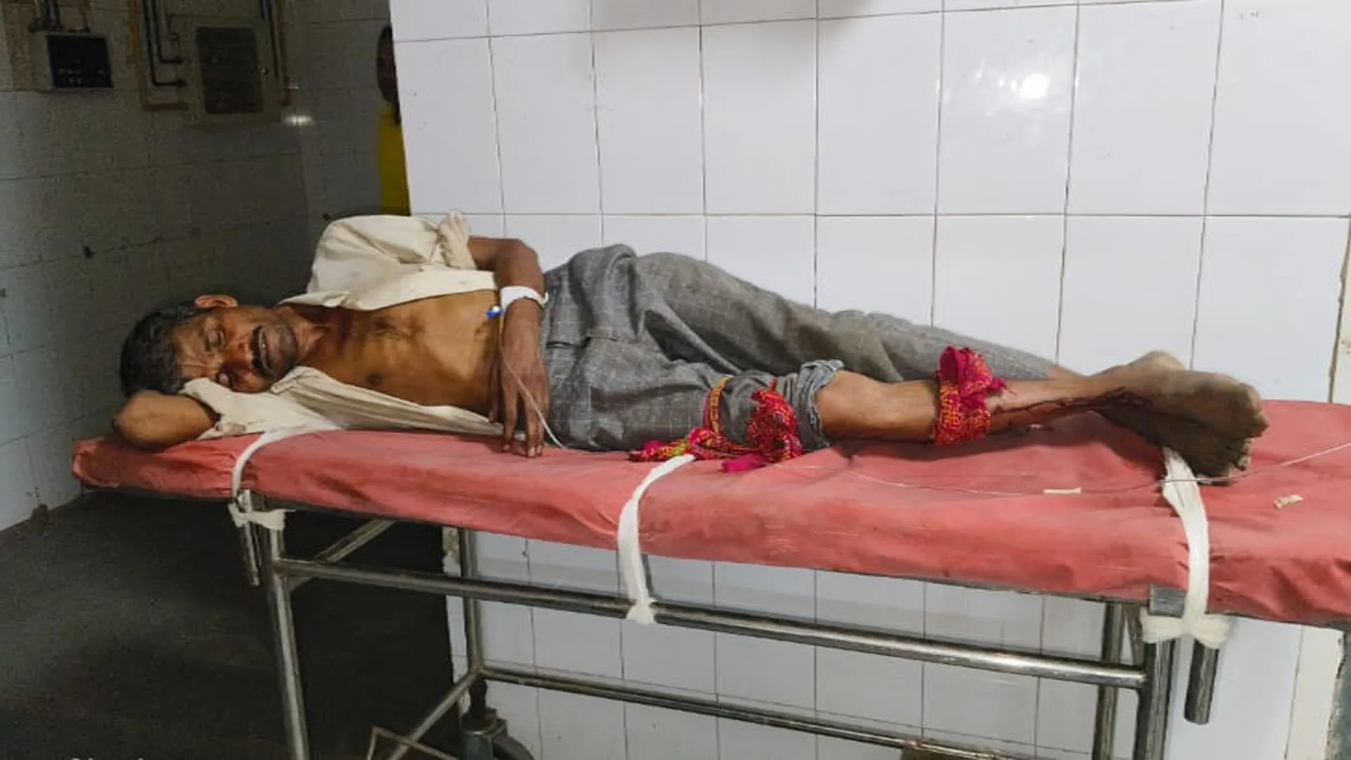 शाहजहांपुर: युवक कोबरा ने डसा...मरा हुआ सांप अस्पताल लेकर पहुंचा तो मची खलबली