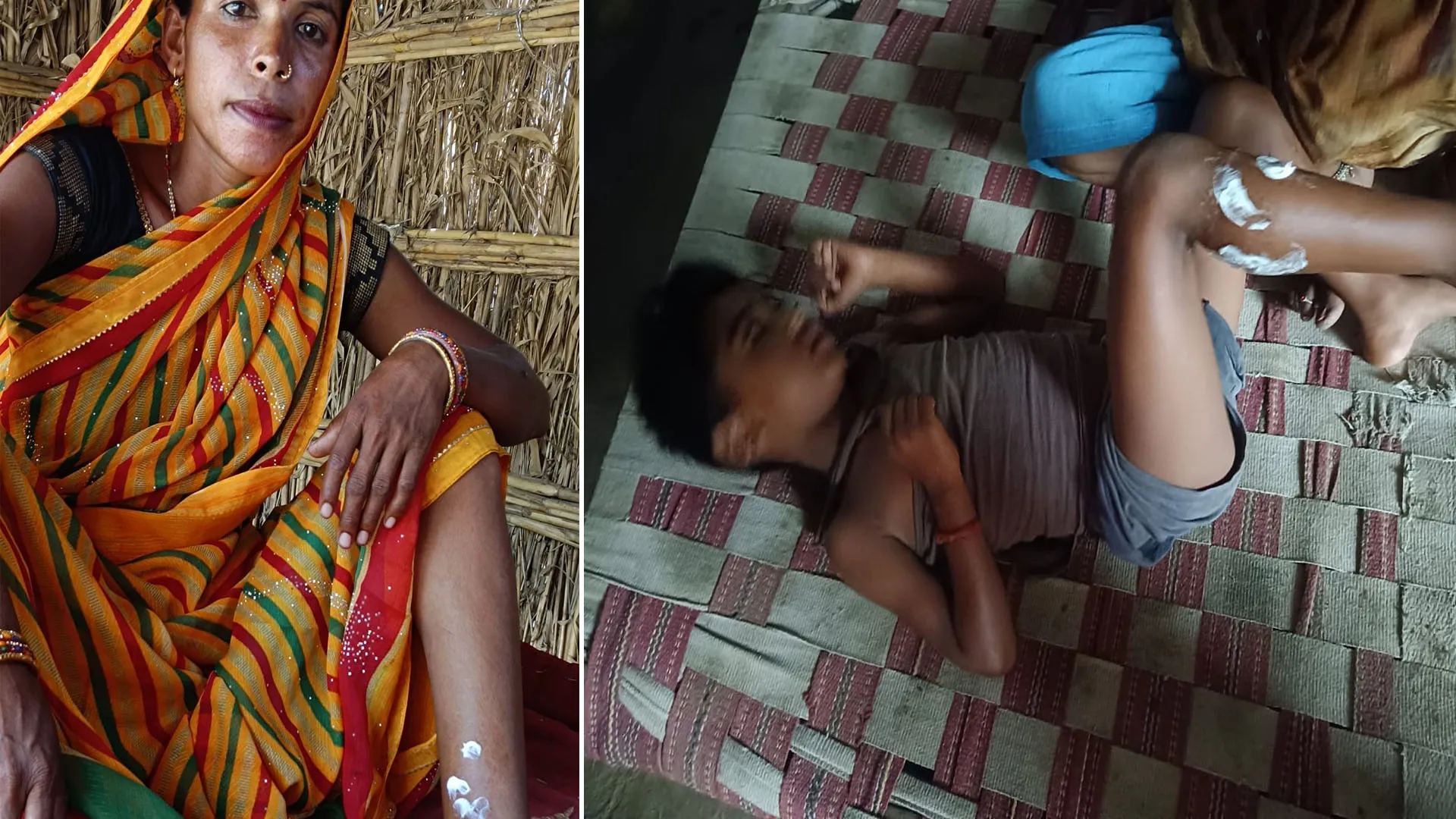 लखीमपुर खीरी: मां-बेटे समेत तीन ग्रामीणों व दो पशुओं पर भेड़िए ने किया हमला