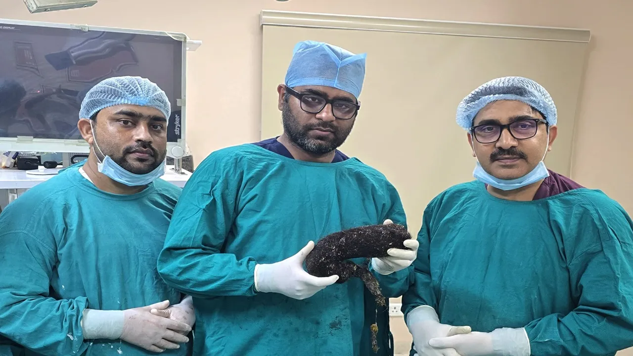 बाल खाने की आदत ने युवती को मौत के मुंह तक पहुंचाया, डॉक्टरों ने कठिन सर्जरी कर बचाई युवती की जान