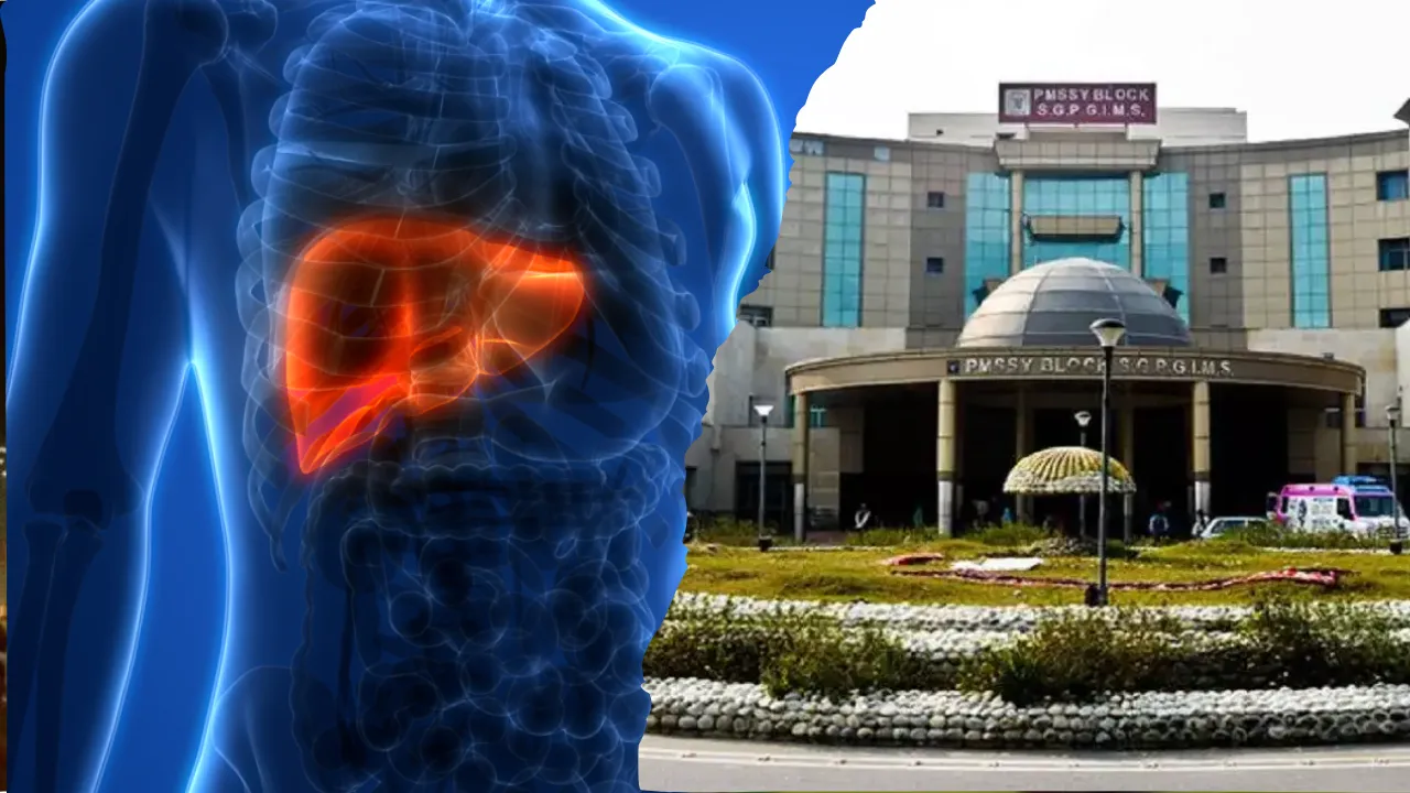 World Hepatitis Day: हेपेटाइटिस से मिलेगी निजात, SGPGI देगा मास्टर क्लास, 200 से ज्यादा प्रतिभागी लेंगे भाग